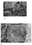 Paleobaculogypsinoides catanduanensis Matsumaru, 2017