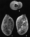 Falsagglutinella byrsa Loeblich & Tappan, 1994