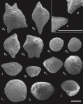 Ornatorotalia spinosa Benedetti, di Carlo & Pignatti, 2011