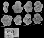 Praepararotalia perclara (Loeblich & Tappan, 1957)