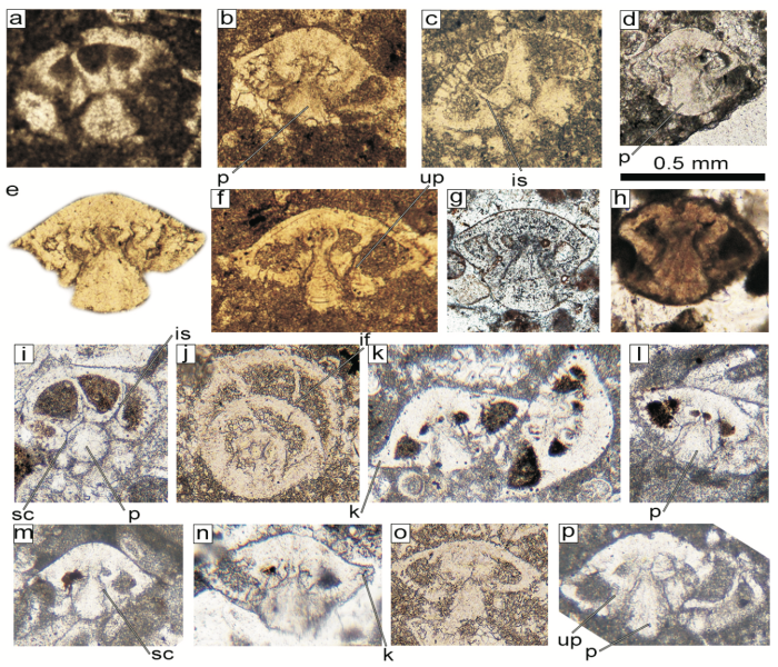 Rotorbinella pachypila Consorti, Bagherpour & Soleimani, 2024 Rotorbinella pachypila Consorti, Bagherpour & Soleimani, 2024