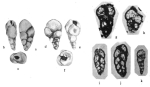 Laterostoma neumannae Hamaoui, 1979