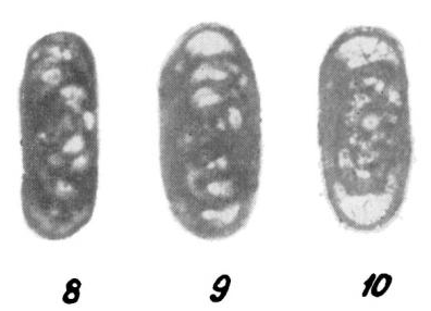 Eostaffella compacta Malakhova, 1975 Eostaffella compacta Malakhova, 1975