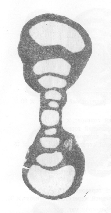 Tournayella moelleri var. uralica Malakhova, 1956 Tournayella moelleri var. uralica Malakhova, 1956