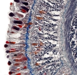 Holotype, transverse section, body wall