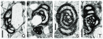 Calcitornella interpsammica Vachard, Krainer & Lucas in Lucas et al., 2016