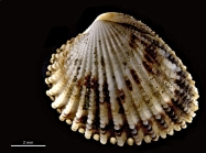 Cardiocardita lacunosa