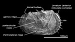 Morphological characters of the valve of Abyssocythere Benson, 1971