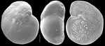 Cibicidoides bradyi