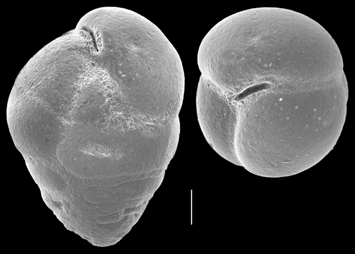 Eggerella bradyi Eggerella bradyi