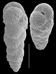Eggerella pusilla