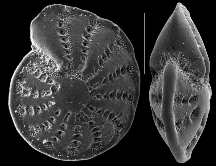 Elphidium punctatum (Terquem, 1878) New Caledonia