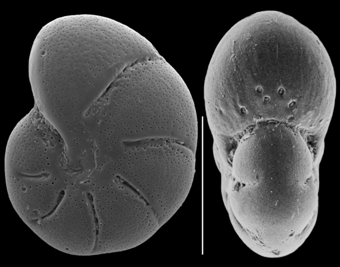 Elphidium sandiegoense Elphidium sandiegoense
