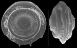 Fissurina calcar