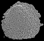 Gypsina vesicularis