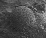 Hemisphaerammina bradyi