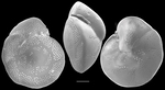 Heterolepa subhaidingeri