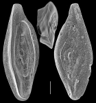 Inaequalina affixa