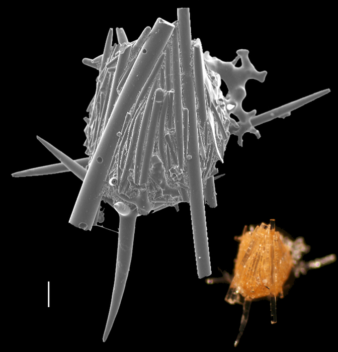 Lagenammina spiculata Lagenammina spiculata