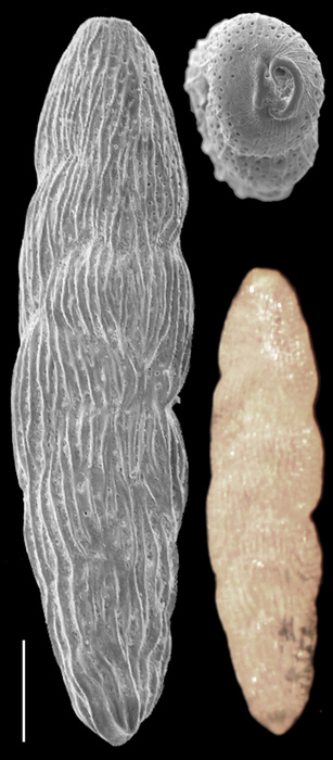 Loxostomina barkeri Loxostomina barkeri