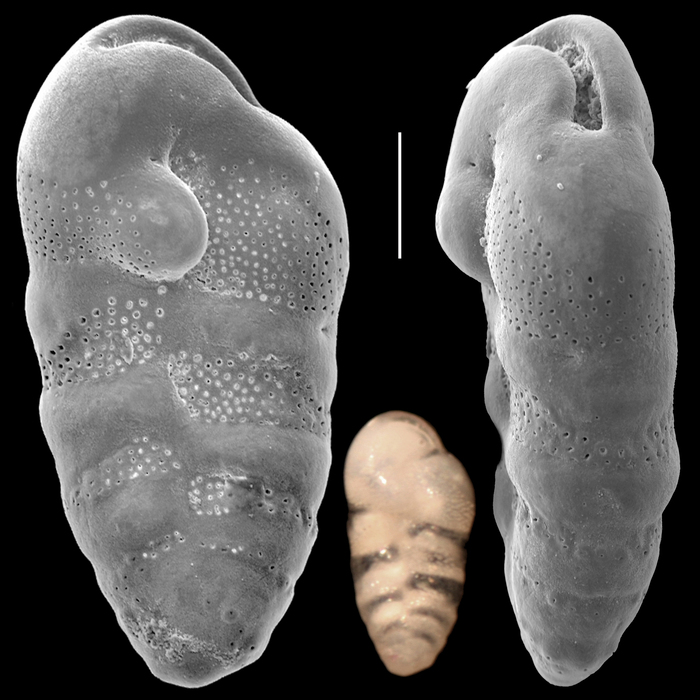 Neocassidulina abbreviata Neocassidulina abbreviata