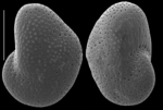 Nonion grossepertusum