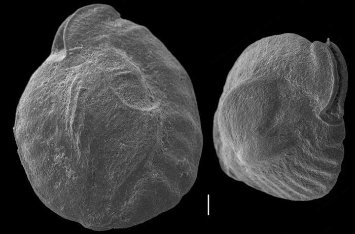 Pseudomassilina pacificensis