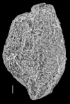 Quinqueloculina agglutinans