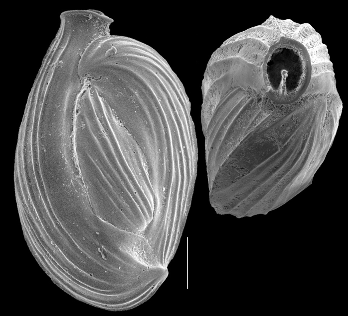 Quinqueloculina carinatastriata Quinqueloculina carinatastriata