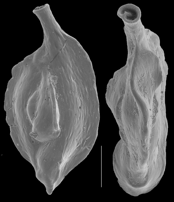 Quinqueloculina collumnosa Quinqueloculina collumnosa