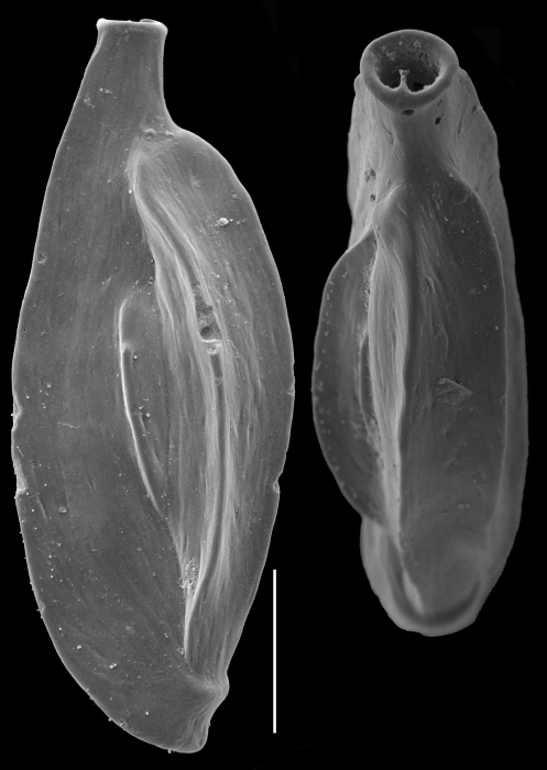Quinqueloculina polygona Quinqueloculina polygona