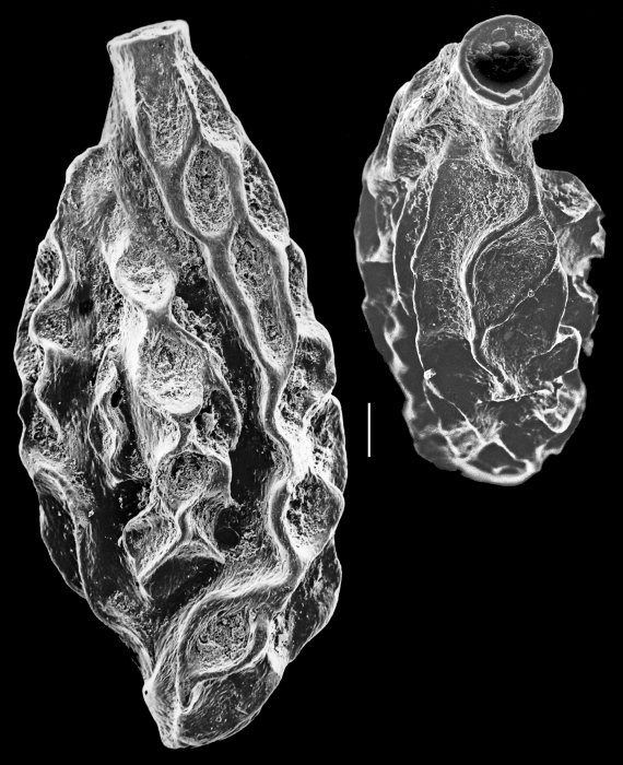 Quinqueloculina rariformis Quinqueloculina rariformis