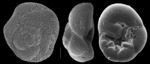 Rosalina globularis