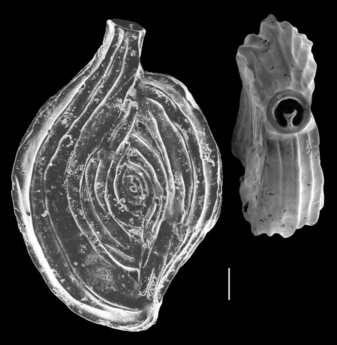 Spiroloculina angulata