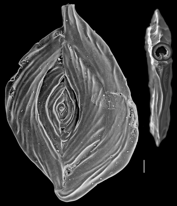 Spiroloculina samoaensis Spiroloculina samoaensis