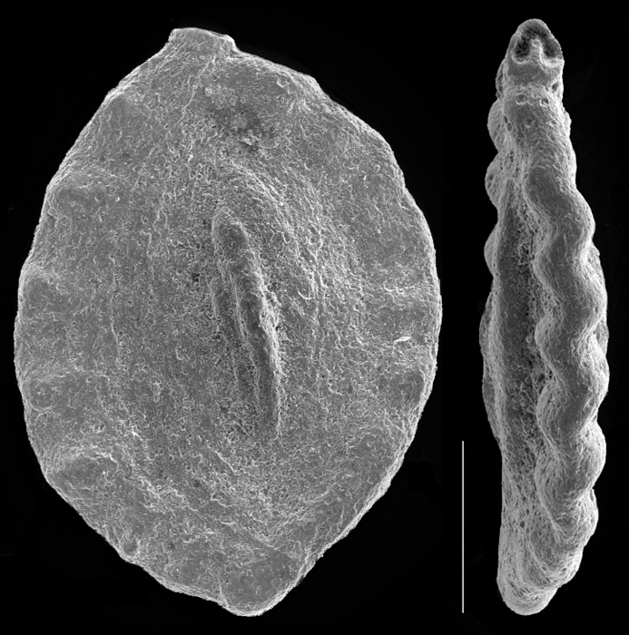 Spirosigmoilina bradyi Spirosigmoilina bradyi