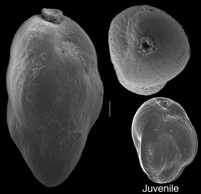 Uvigerina carapitana Uvigerina carapitana