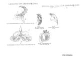 Leiosoma rosea, author: Henry W. Bremann, Henri Ribaut, Maria Prin, Jean-Paul Mauri et al. (1890-1999): Bremann iconographic file & successors