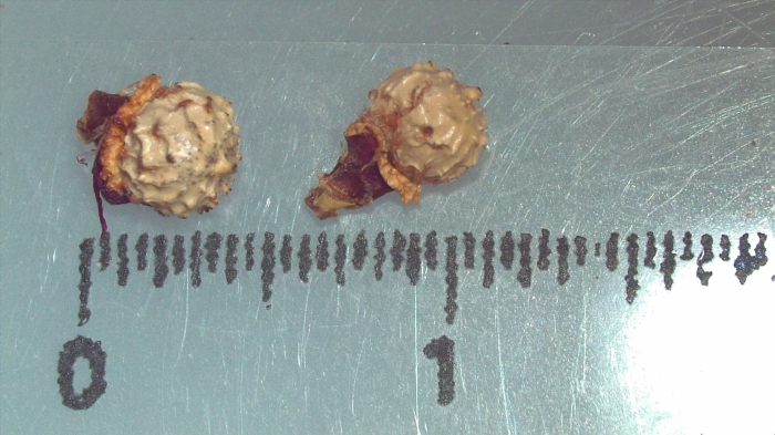 Nutlet of Scleria atroglumis K000189782 1