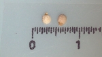 Nutlet of Scleria bambariensis K002787325 1