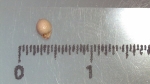 Nutlet of Scleria ciliaris K000498663 1