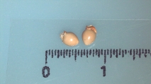 Nutlet of Scleria naumanniana K002785931 1, author: Javier Gal-Dz