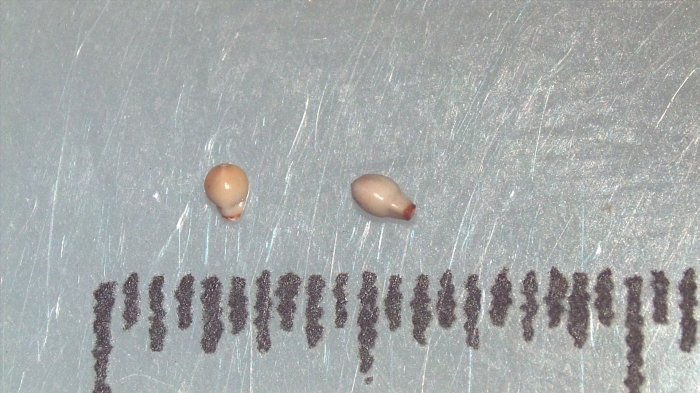 Nutlet of Scleria paupercula K002788028 1