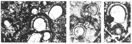 Tubesphaera cognata Vachard, 1994, author: Le Coze, François