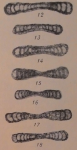 Ammodiscus compactus Brazhnikova & Potievskaya in Manukalova-Grebenyuk et al., 1969