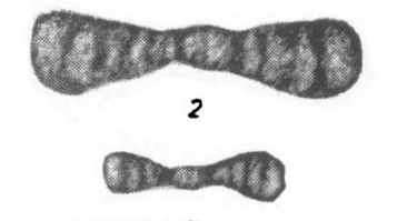 Ammodiscus diadema var. umbonata Potievskaya, 1958 Ammodiscus diadema var. umbonata Potievskaya, 1958