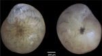 Amphistegina lobifera Larsen, 1976