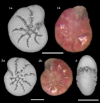 Cribroelphidium excavatum (Terquem 1876), France