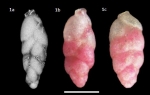 Hopkinsina atlantica Cushman, 1944
