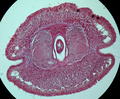 Nemertea (ribbon worms)